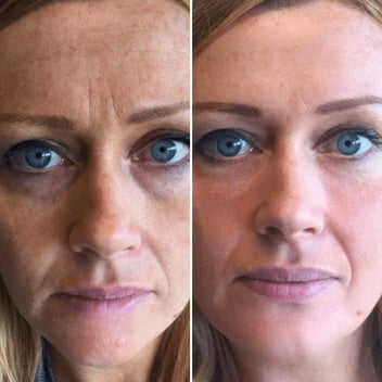 Comparaison de deux portraits de face.